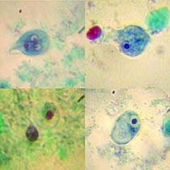 Microbial Identification Control Slide Entamoeba Nana 5 Slides