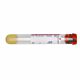 BD Vacutainer® SST Venous Blood Collection Tube Serum Tube Clot Activator / Separator Gel Additive 16 X 100 mm 8.5 mL Red / Gray Mottled Conventional Closure Plastic Tube