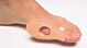 Bunion Shield AliMed® One Size Fits Most Pull-On Foot