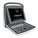 Ultrasound System Chison 256 Levels Scale, 240 mm Max Depth Scanning, 3 USB ports, 1 Probe Connectors, 8 GB Memory Card, PW Mode