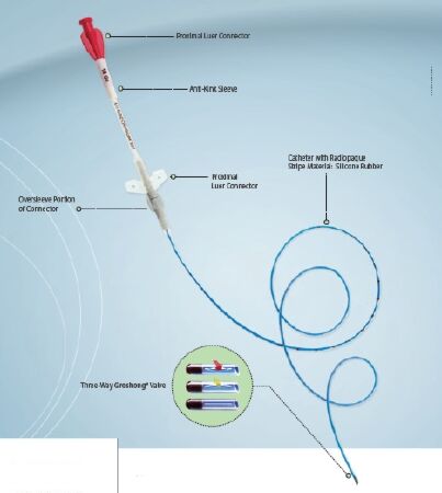 Central Venous Catheter Tray Groshong® Nxt Clearvue® 3 Fr. Single Lumen